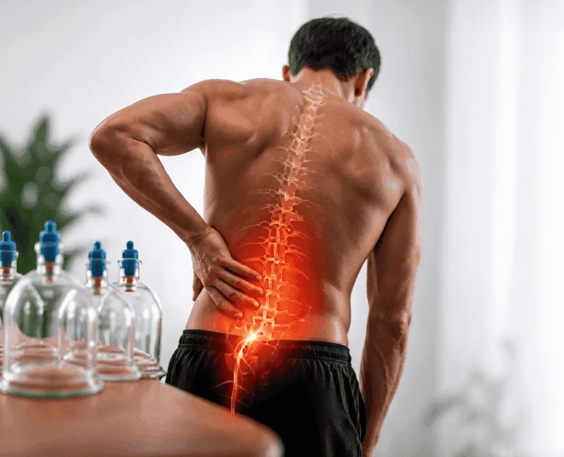 علاج عرق النسا بالحجامة: هل يُخفف الألم فعلاً؟